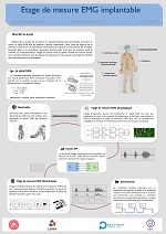 Étage de mesure EMG implantable